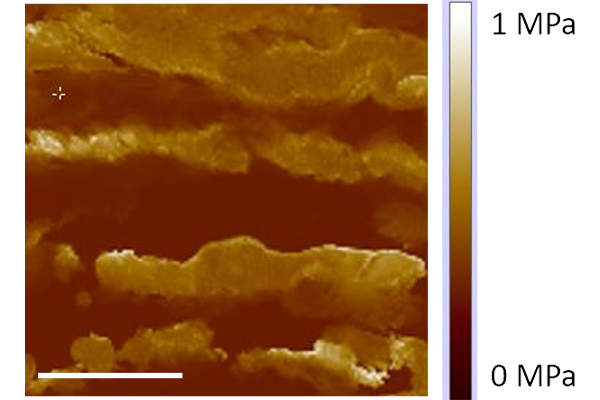 Jessica Wagenseil and her team will take a closer look at the mechanics on smooth muscle cells in the aortic wall with a new NIH grant. (Credit: Wagenseil lab)