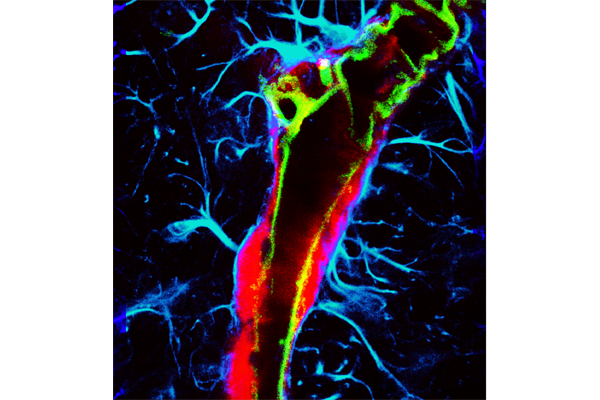 The image shows a microscopic image revealing the enhanced glymphatic transport of an intranasally delivered tracer (red), achieved using ultrasound combined with microbubbles. (Credit: Chen lab)  