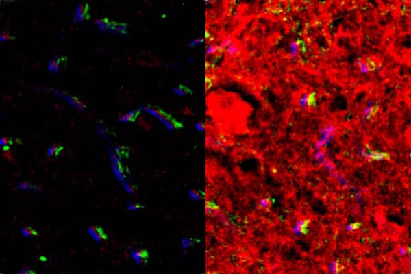  Fluorescence images of the brainstem obtained from nontumor mice after intranasal delivery (left) and FUSIN delivery (right). The brainstem, where the glioma was implanted, showed enhanced fluorescence signal by FUSIN compared with IN only. 