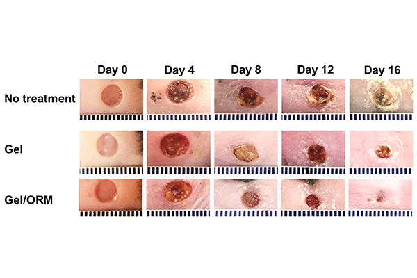 Representative images of the wounds treated with or without gel and oxygen-release microspheres for 16 days. 