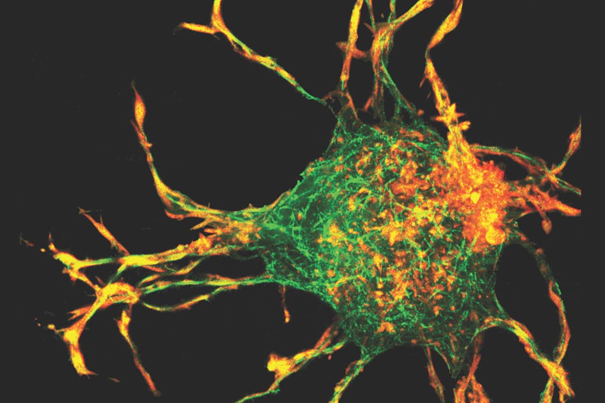 Fibroblast morphology in 3D with no actomyosin contractility.