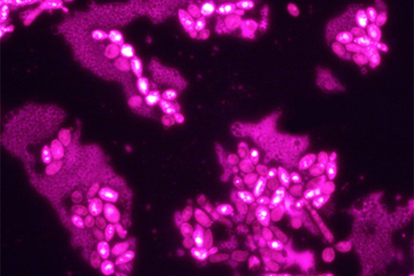 Nonmodel yeast (Yarrowia) that can be engineered to make natural products, such as flavonoid; biodiesel oil; and alcohols, such as butanol. (Courtesy image)